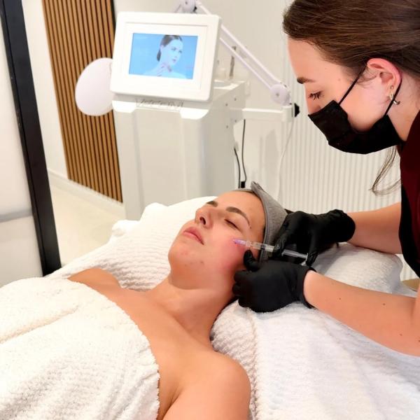 Hemijski piling + mezoterapija / microneedling