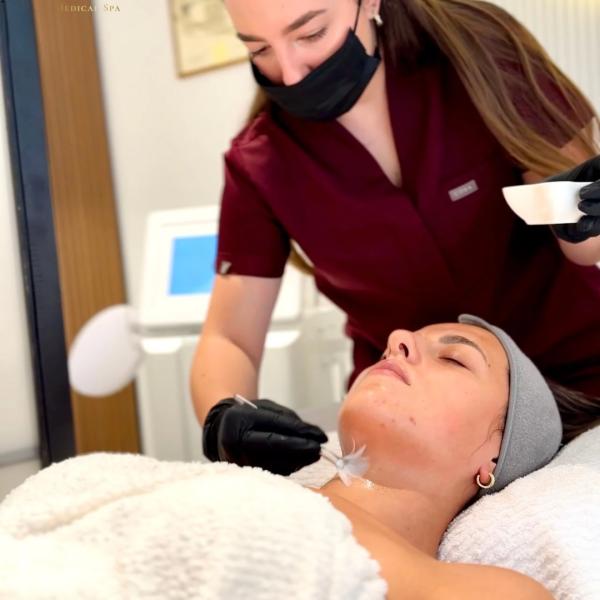 Hemijski piling + mezoterapija / microneedling